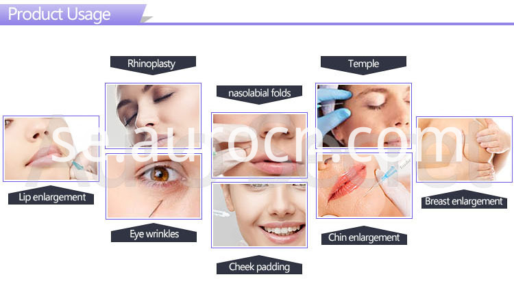 intra-artikulär injektion av hyaluronsyra hyaluronic acid intra-articular injection